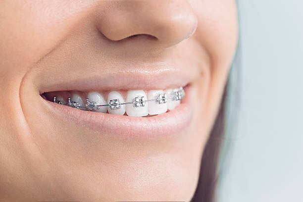 Best Dental Fillings (Composite and Amalgam)  in Hector, MN